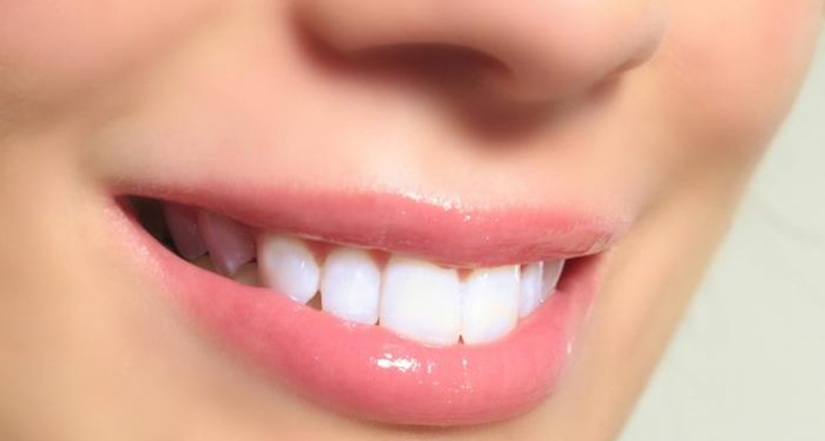Cara Alami Memutihkan Gigi