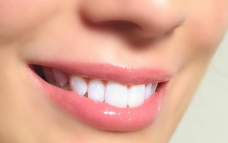 Cara Alami Memutihkan Gigi